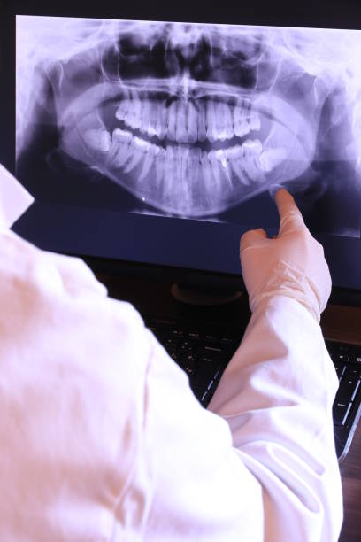 Best Dentist for Tooth Abscess  in San Ramon, CA